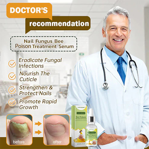 LOVILDS™ Nail Fungus Bee Poison Treatment Serum 7 LOVILDS™ Nail Fungus Bee Poison Treatment Serum