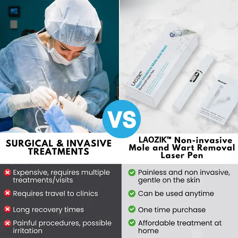 LAOZIK® Non-Invasive Mole and Wart Removal Laser Pen 6 LAOZIK® Non-Invasive Mole and Wart Removal Laser Pen