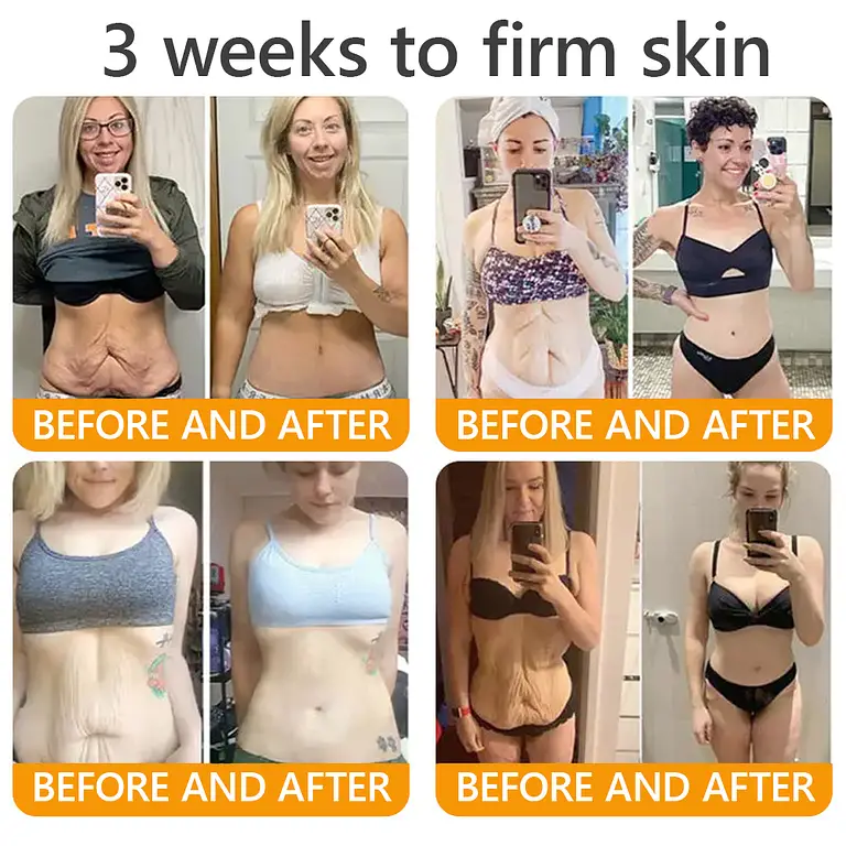 sabax® Bee Venom Comprehensive Cream 11 sabax® Bee Venom Comprehensive Cream