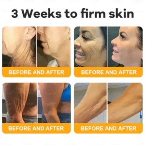 VLSVLS® Bee Venom Comprehensive Cream 19 VLSVLS® Bee Venom Comprehensive Cream