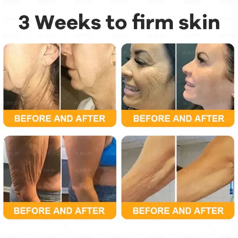 VLSVLS® Bee Venom Comprehensive Cream 9 VLSVLS® Bee Venom Comprehensive Cream