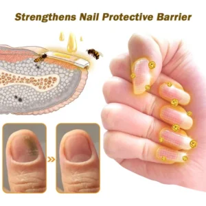 LOVILDS™ Nail Fungus Bee Poison Treatment Serum 15 LOVILDS™ Nail Fungus Bee Poison Treatment Serum