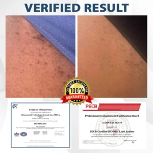 Fivfivgo® ManGuard HPV WART Healing Cream 7 Fivfivgo® ManGuard HPV WART Healing Cream