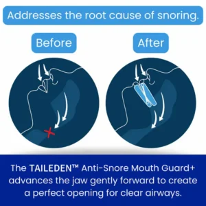TAILEDEN™ Anti-Snore Mouth Guard+ 14 TAILEDEN™ Anti-Snore Mouth Guard+