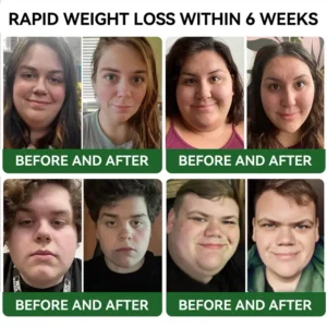 TLOPA® GLP-1 Slimming & Health Boost Drops 12 TLOPA® GLP-1 Slimming & Health Boost Drops