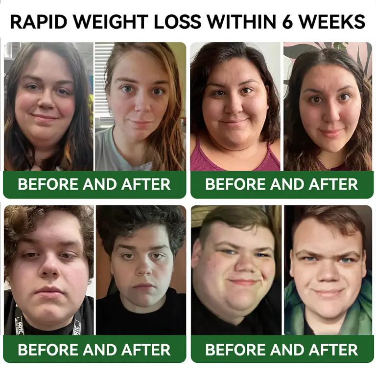 TLOPA® GLP-1 Slimming & Health Boost Drops 4 TLOPA® GLP-1 Slimming & Health Boost Drops