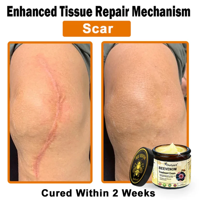 Ourlyard® Botulinum Toxin & Bee Venom Skin Treatment Cream 10 Ourlyard® Botulinum Toxin & Bee Venom Skin Treatment Cream