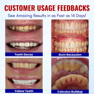 AEXZR® Baking Soda Oral Health Toothpaste 13 AEXZR® Baking Soda Oral Health Toothpaste