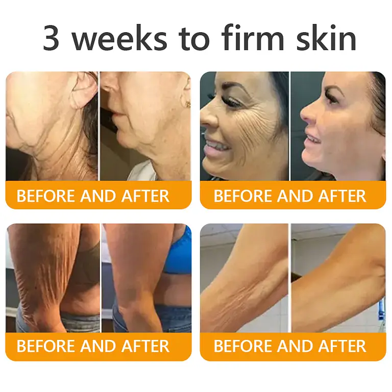 sabax® Bee Venom Comprehensive Cream 9 sabax® Bee Venom Comprehensive Cream