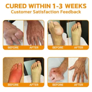 LOVILDS™Bees Pain Relief Bone Healing Cream 14 LOVILDS™Bees Pain Relief Bone Healing Cream