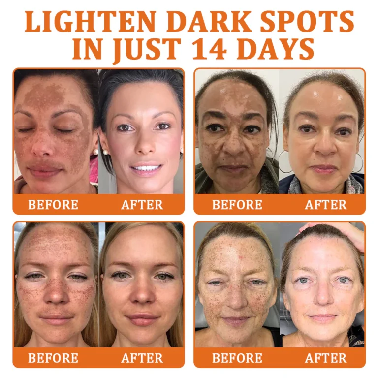 Flysmus Botox Bee Venom Treatment Serum Stick 8 Flysmus Botox Bee Venom Treatment Serum Stick