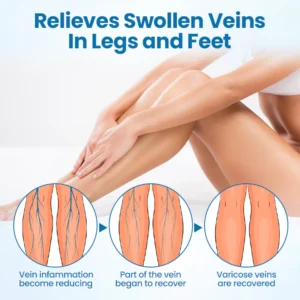 Timilk® VeinGuard Herbal Spray 14 Timilk® VeinGuard Herbal Spray