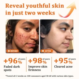 Flysmus Botox Bee Venom Treatment Serum Stick 16 Flysmus Botox Bee Venom Treatment Serum Stick