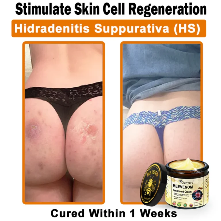 Ourlyard® Botulinum Toxin & Bee Venom Skin Treatment Cream 6 Ourlyard® Botulinum Toxin & Bee Venom Skin Treatment Cream