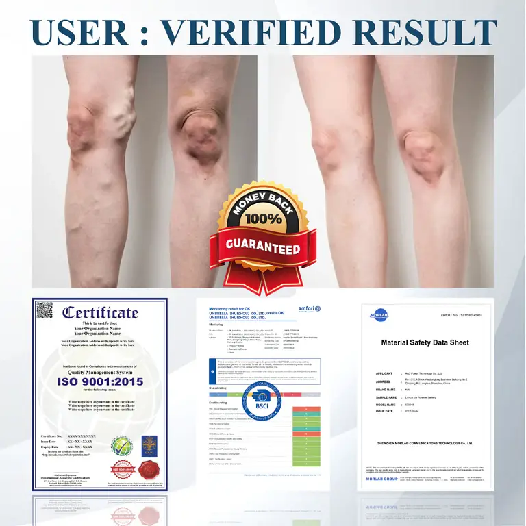 ATTDX® Black Cumin Edema Soothing Herbal Cream 7 ATTDX® Black Cumin Edema Soothing Herbal Cream