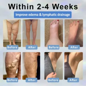 ATTDX® Black Cumin Edema Soothing Herbal Cream 17 ATTDX® Black Cumin Edema Soothing Herbal Cream