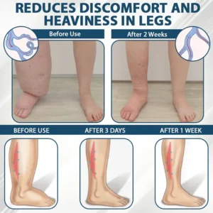 ATTDX® Black Cumin Edema Soothing Herbal Cream 23 ATTDX® Black Cumin Edema Soothing Herbal Cream