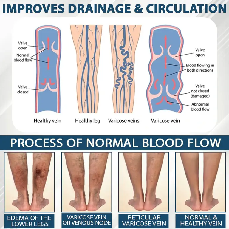 ATTDX® Black Cumin Edema Soothing Herbal Cream 10 ATTDX® Black Cumin Edema Soothing Herbal Cream