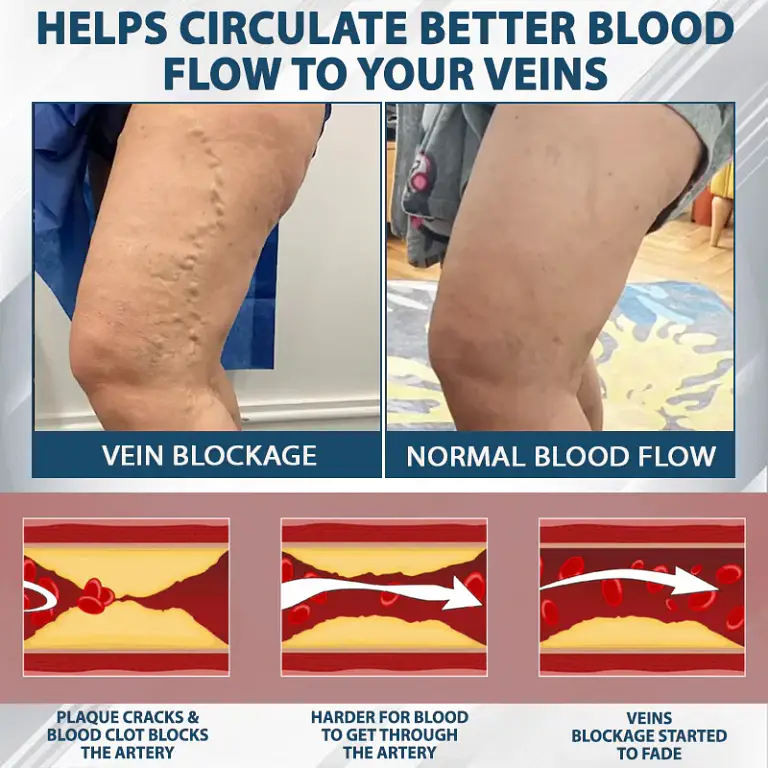 ATTDX® Black Cumin Edema Soothing Herbal Cream 9 ATTDX® Black Cumin Edema Soothing Herbal Cream