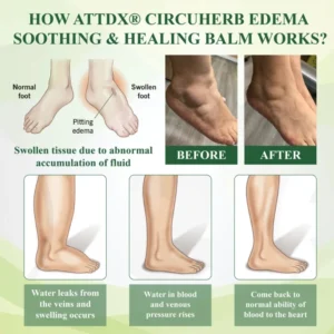 ATTDX® CircuHerb Edema Soothing & Healing Balm 18 ATTDX® CircuHerb Edema Soothing & Healing Balm