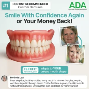 SmileCraft™ Custom-Fit Functional Dentures