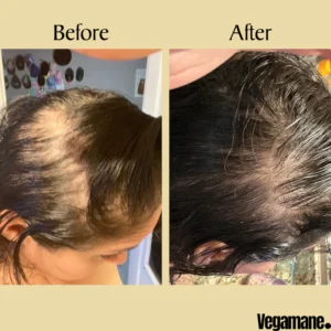 Vegamane Natural Hair Growth Oil 13 Vegamane Natural Hair Growth Oil