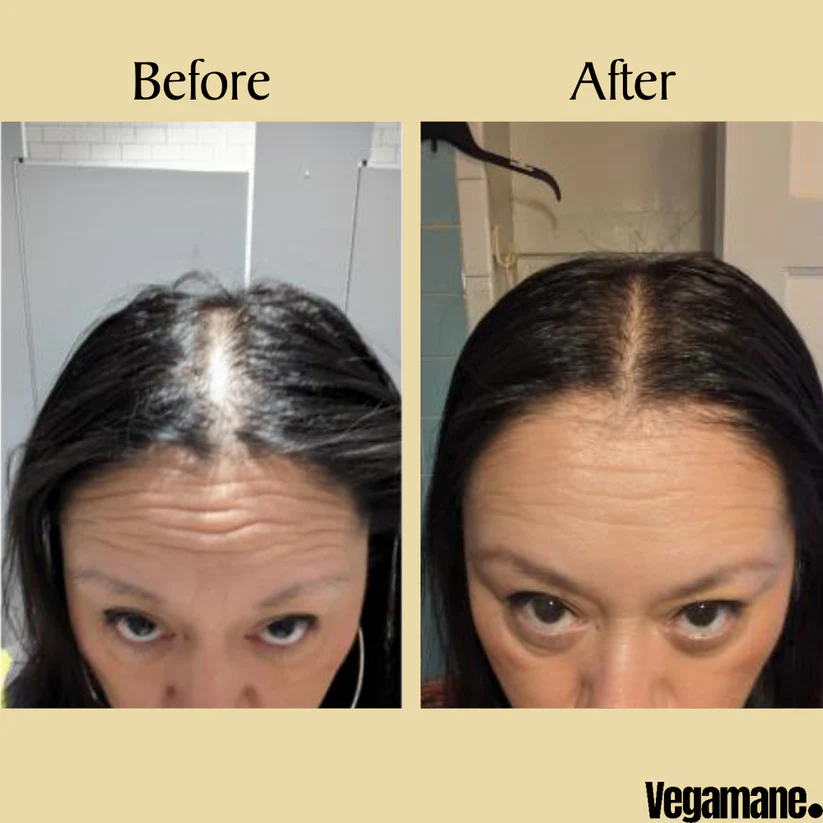 Vegamane Natural Hair Growth Oil 5 Vegamane Natural Hair Growth Oil