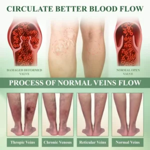 ATTDX® CircuHerb Edema Soothing & Healing Balm 14 ATTDX® CircuHerb Edema Soothing & Healing Balm