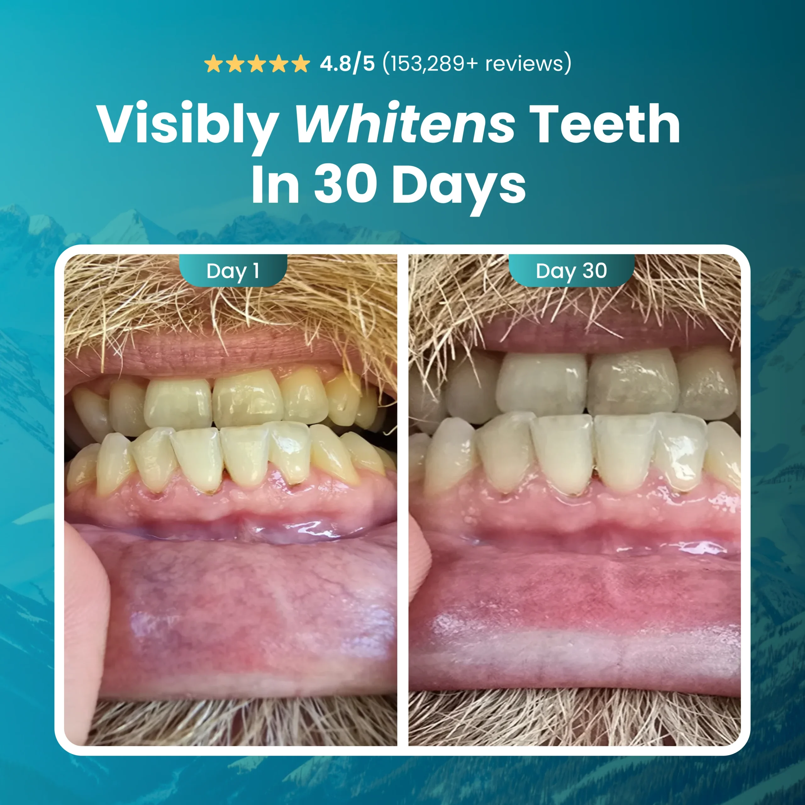 Larineco™️ - Remineralizing Gum 6 Larineco™️ - Remineralizing Gum