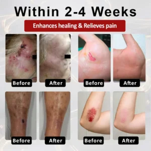 CVREOZ® GlucoseGuard Skin Rescue Cream 20 CVREOZ® GlucoseGuard Skin Rescue Cream