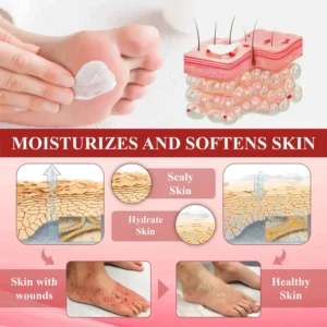 CVREOZ® GlucoseGuard Skin Rescue Cream 16 CVREOZ® GlucoseGuard Skin Rescue Cream