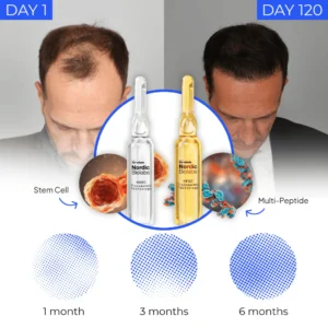 Regrow your hair in 120 days with STEM Cell Complete Hair Cycle Solution 2.0 or your money back