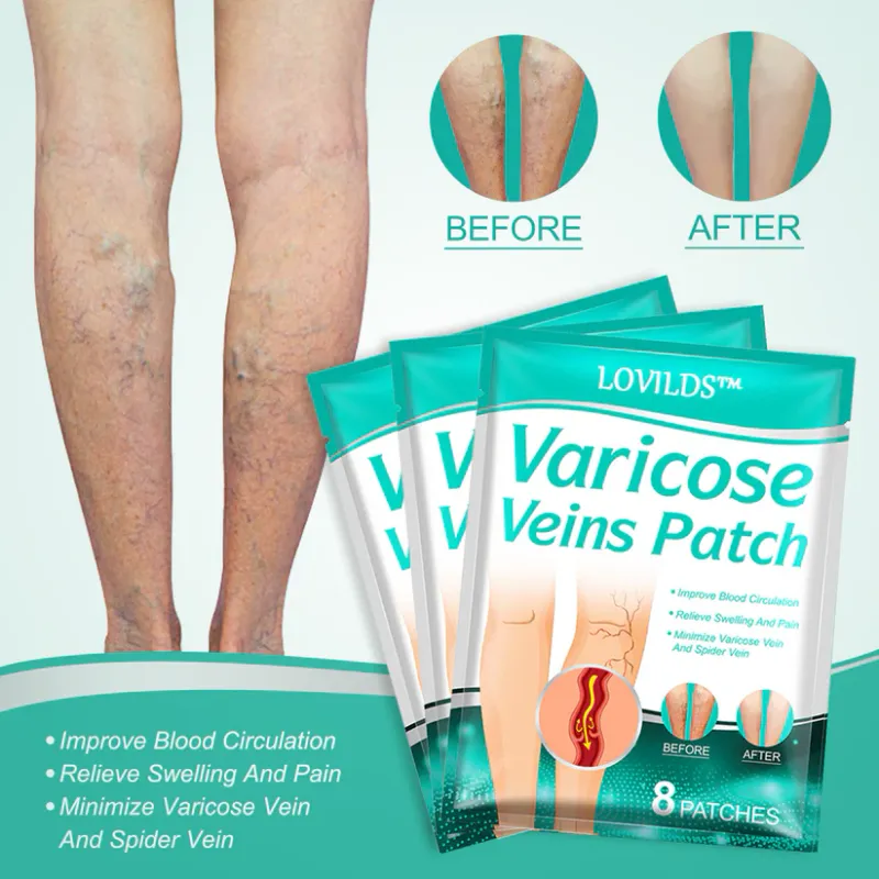 LOVILDS - Leech Varicose Veins Patch 7 LOVILDS - Leech Varicose Veins Patch