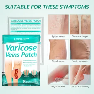 LOVILDS - Leech Varicose Veins Patch 13 LOVILDS - Leech Varicose Veins Patch
