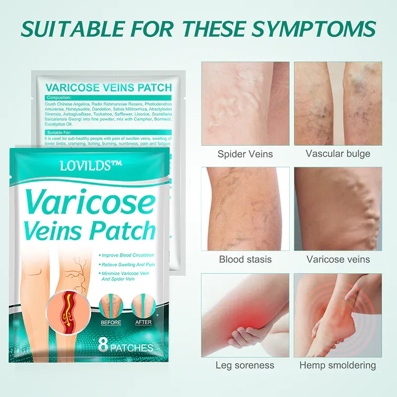 LOVILDS - Leech Varicose Veins Patch 4 LOVILDS - Leech Varicose Veins Patch