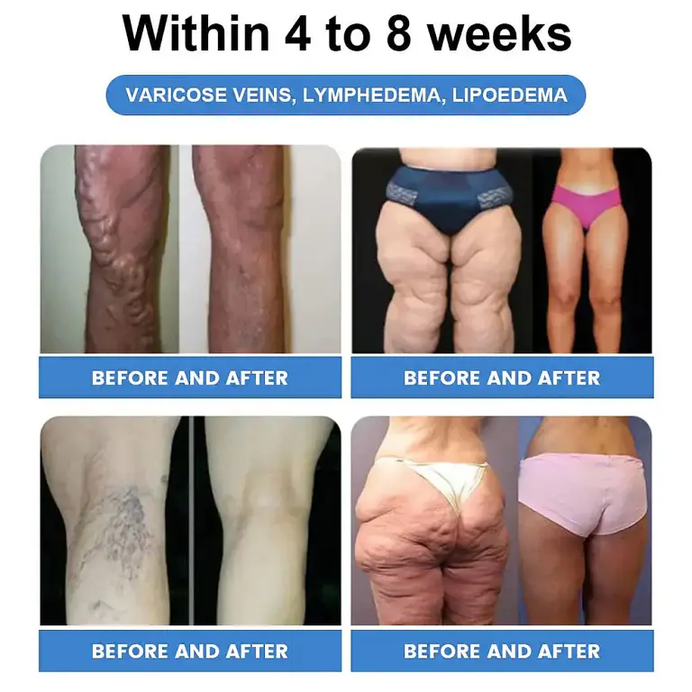 CROAIE® GLP-1 Slimming & Health Boost Drops 10 CROAIE® GLP-1 Slimming & Health Boost Drops