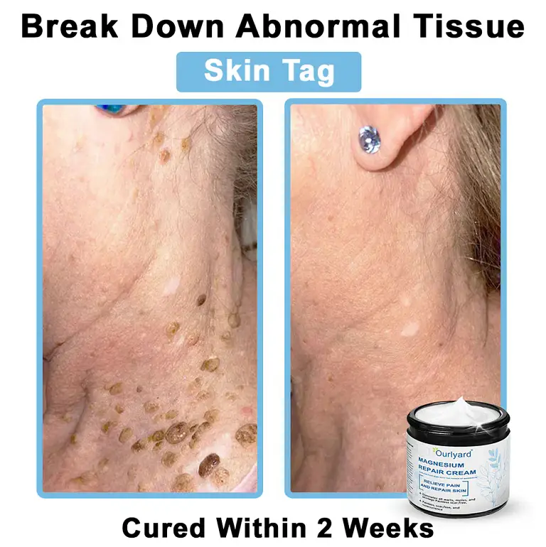 Ourlyard® Magnesium skin repair cream 5 Ourlyard® Magnesium skin repair cream