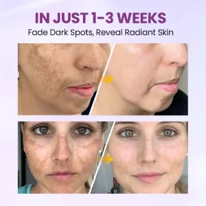 Clinclii™ Radiant Clear Blemish & Brightening Serum 12 Clinclii™ Radiant Clear Blemish & Brightening Serum