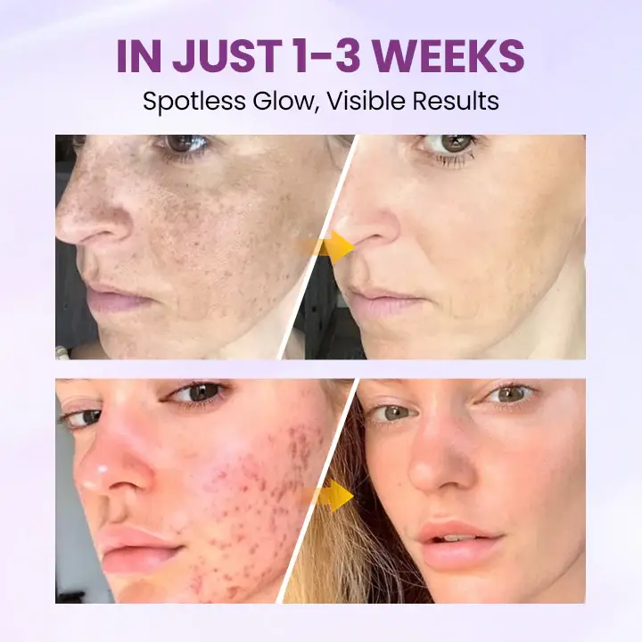 Clinclii™ Radiant Clear Blemish & Brightening Serum 2 Clinclii™ Radiant Clear Blemish & Brightening Serum