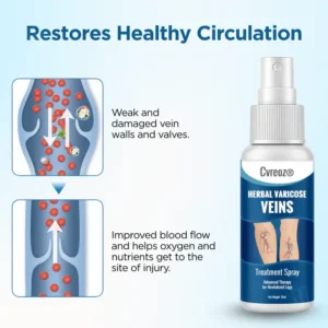Cvreoz® Herbal Varicose Veins Treatment Spray 12 Cvreoz® Herbal Varicose Veins Treatment Spray