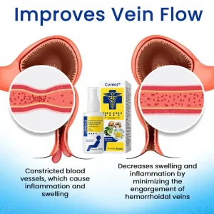 Cvreoz® Herbal Hemorrhoids Fast-Acting Treatment Spray 11 Cvreoz® Herbal Hemorrhoids Fast-Acting Treatment Spray