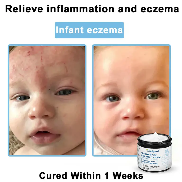 Ourlyard® Magnesium skin repair cream 4 Ourlyard® Magnesium skin repair cream