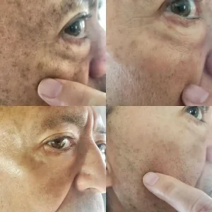 AQA™ Melanin Correcting Facial Serum 19 AQA™ Melanin Correcting Facial Serum