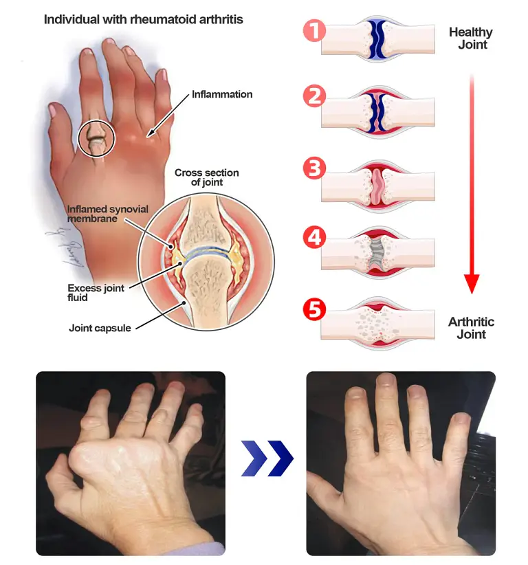 ADFIRE® Dual Action Pain Relief 4 ADFIRE® Dual Action Pain Relief