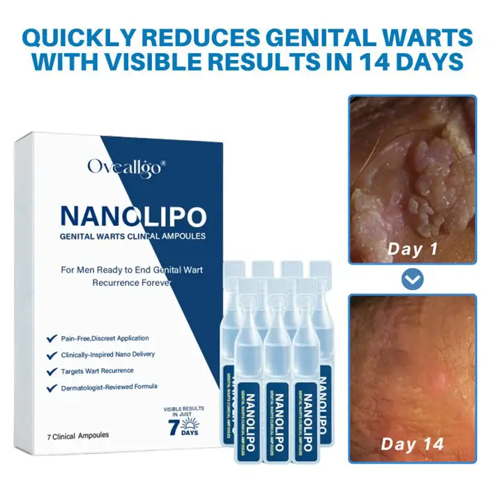 Oveallgo® NANOLIPO GENITAL WARTS CLINICAL AMPOULES 5 Oveallgo® NANOLIPO GENITAL WARTS CLINICAL AMPOULES