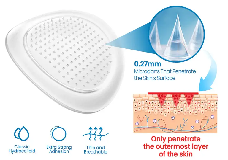 KUBOZN® Joint Pain & Inflammation Relief Microdarts Patch 6 KUBOZN® Joint Pain & Inflammation Relief Microdarts Patch