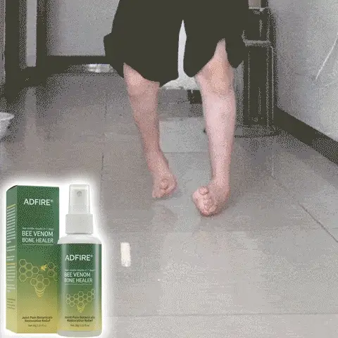 Adfire® Bee Venom Bone & Joint Revive Spray 10 Adfire® Bee Venom Bone & Joint Revive Spray
