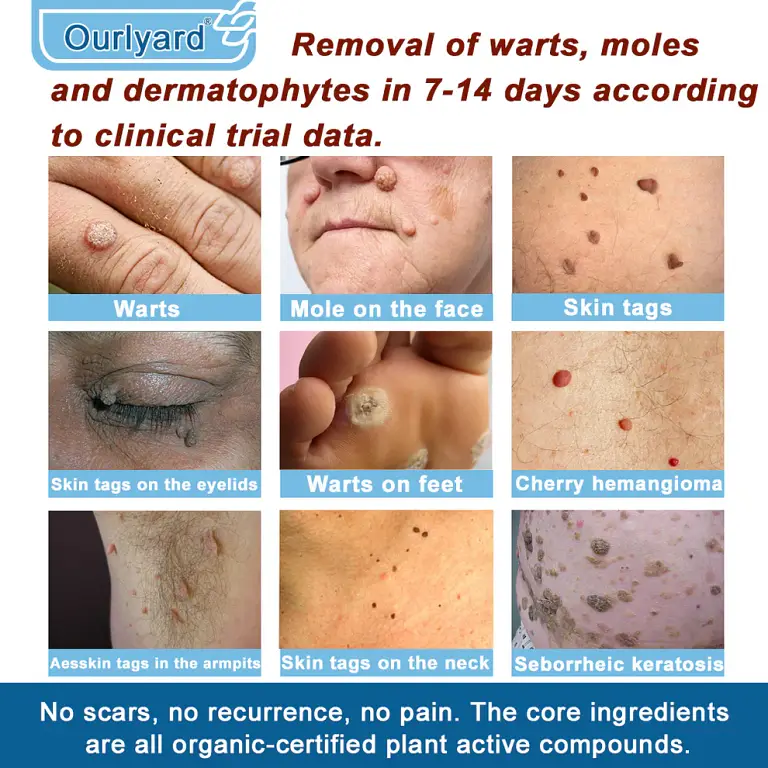 Ourlyard® Magnesium skin repair cream 11 Ourlyard® Magnesium skin repair cream