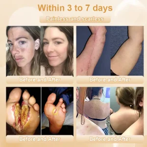 JORONDY® Bee Bright Kolirin Advanced Cream 12 JORONDY® Bee Bright Kolirin Advanced Cream