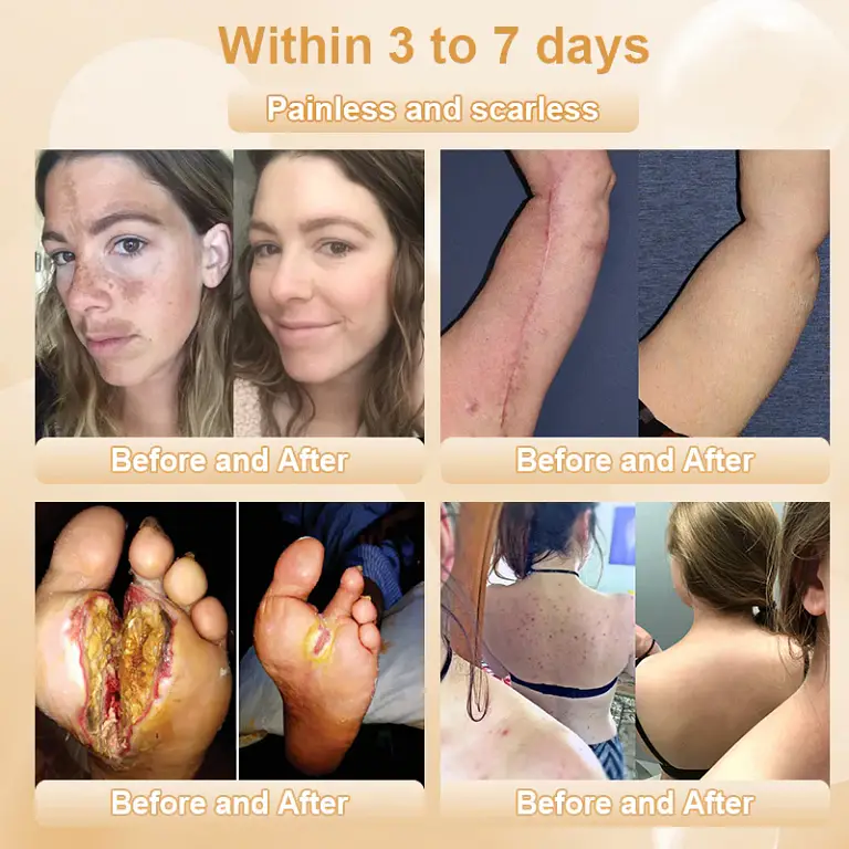 JORONDY® Bee Bright Kolirin Advanced Cream 3 JORONDY® Bee Bright Kolirin Advanced Cream